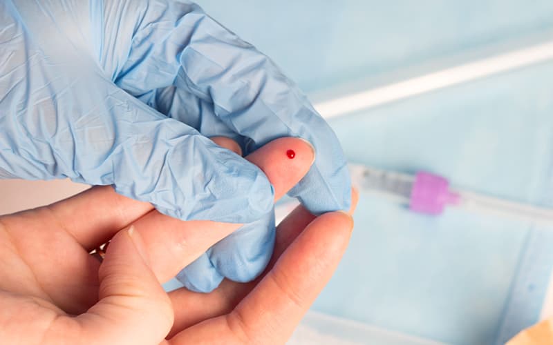 「HIV検査キット」の中には信頼度の低い郵送検査も。また、陽性反応が出た場合は、改めて医療機関でスクリーニング検査、および確認検査を行う必要があるため、まず医療機関で検査をした方が効率的。