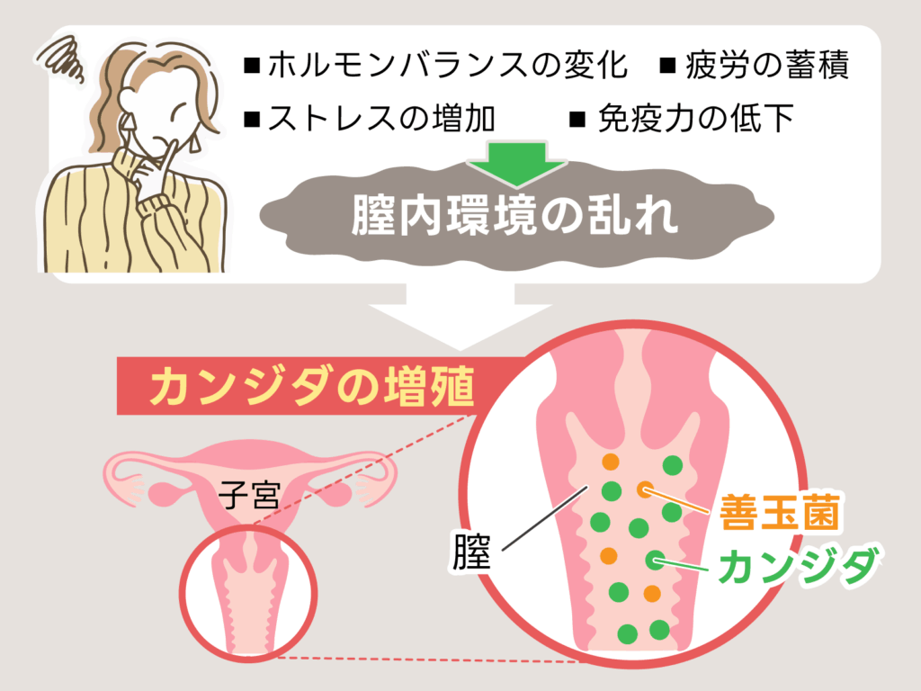 膣カンジダの原因と症状